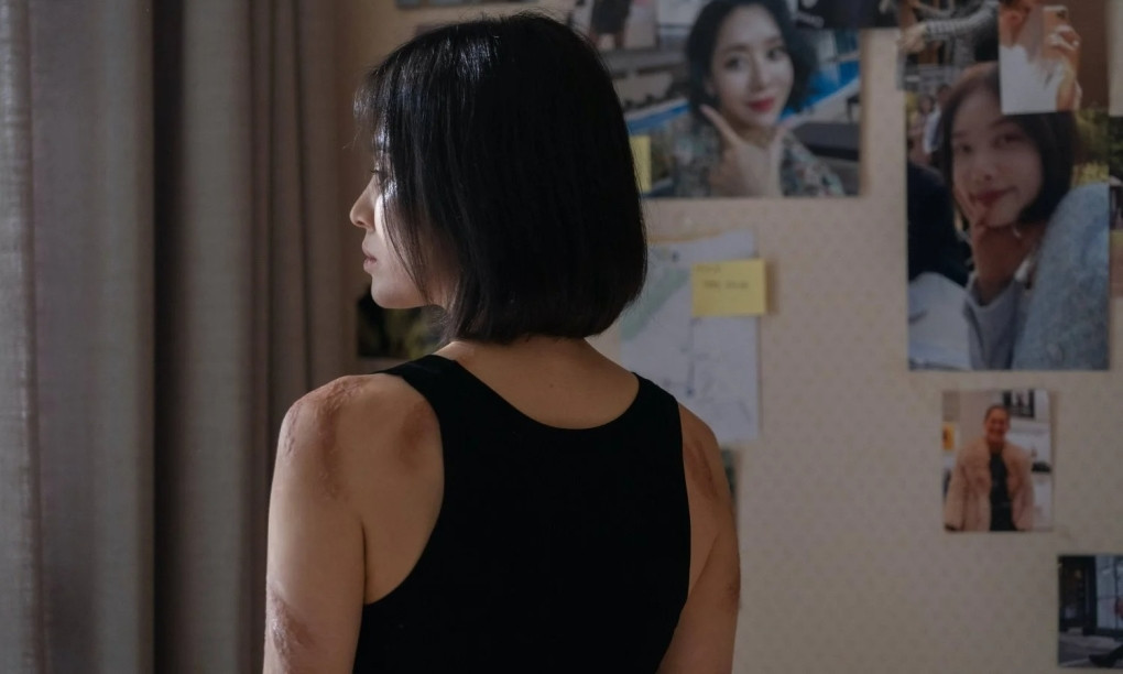 Những vết sẹo trên cơ thể Dong Eun được hóa trang trong nhiều tiếng. Những vết sẹo trên cơ thể Dong Eun được hóa trang trong nhiều tiếng.