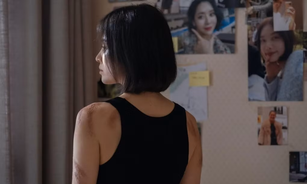 Những vết sẹo trên cơ thể Dong Eun được hóa trang trong nhiều tiếng.