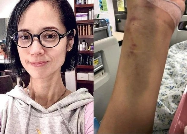 Trịnh Diễm Lệ sức khỏe xuống dốc vì bệnh tâm lý và chứng biếng ăn.