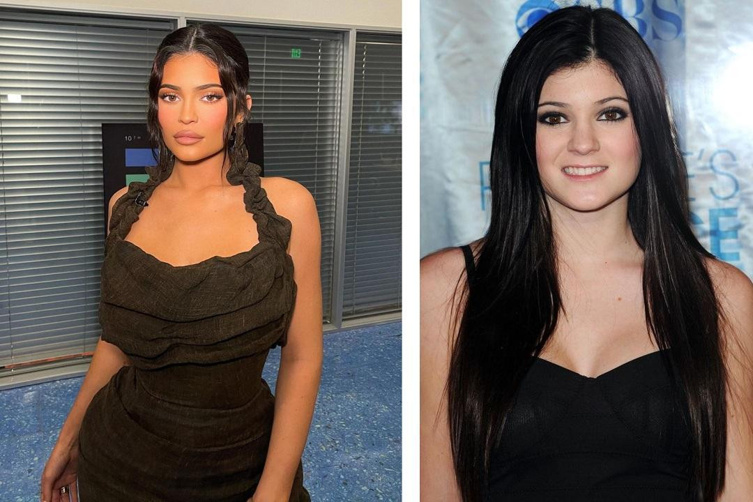Kylie từng tự tin vì đôi môi nhỏ và mỏng, đến mức cô bị ám ảnh bởi kẻ môi và tiêm filler. Kylie từng tự tin vì đôi môi nhỏ và mỏng, đến mức cô bị ám ảnh bởi kẻ môi và tiêm filler.
