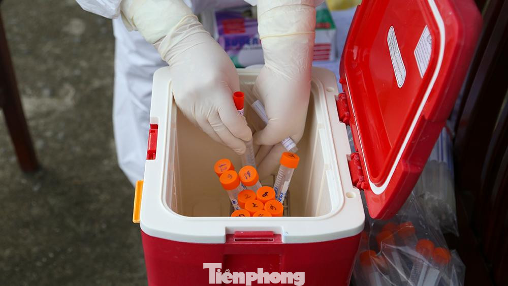 Mẫu được bảo quản và vận chuyển đến phòng xét nghiệm trước 48 giờ kể từ khi lấy mẫu. Mẫu được bảo quản và vận chuyển đến phòng xét nghiệm trước 48 giờ kể từ khi lấy mẫu.