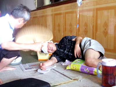 Nguyễn Anh Dũng với vết bỏng khá nặng ở hai chân