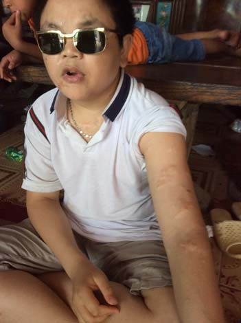 Nỗi đau của nạn nhân duy nhất còn sống sau thảm án cuồng ghen ảnh 1