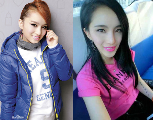 Ca sĩ sinh năm 1990 Lý Vũ Hề (tên thật Lý Viên Hy) vốn có gương mặt khá xinh xắn. Mặt cô hiện nay dài ra một cách bất thường.