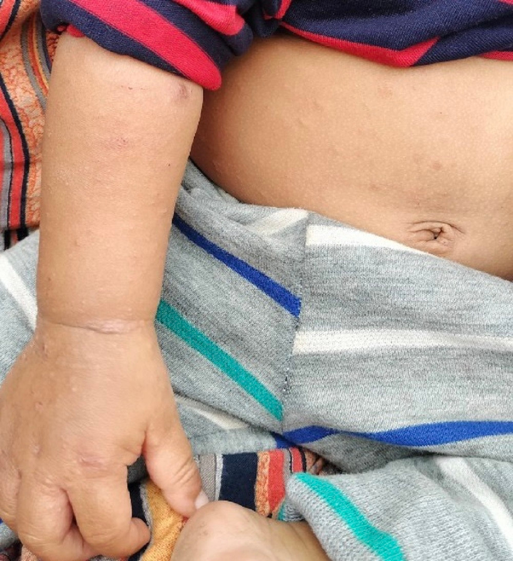 Đáng chú ý trong đó có cả trẻ em dưới 1 tuổi.