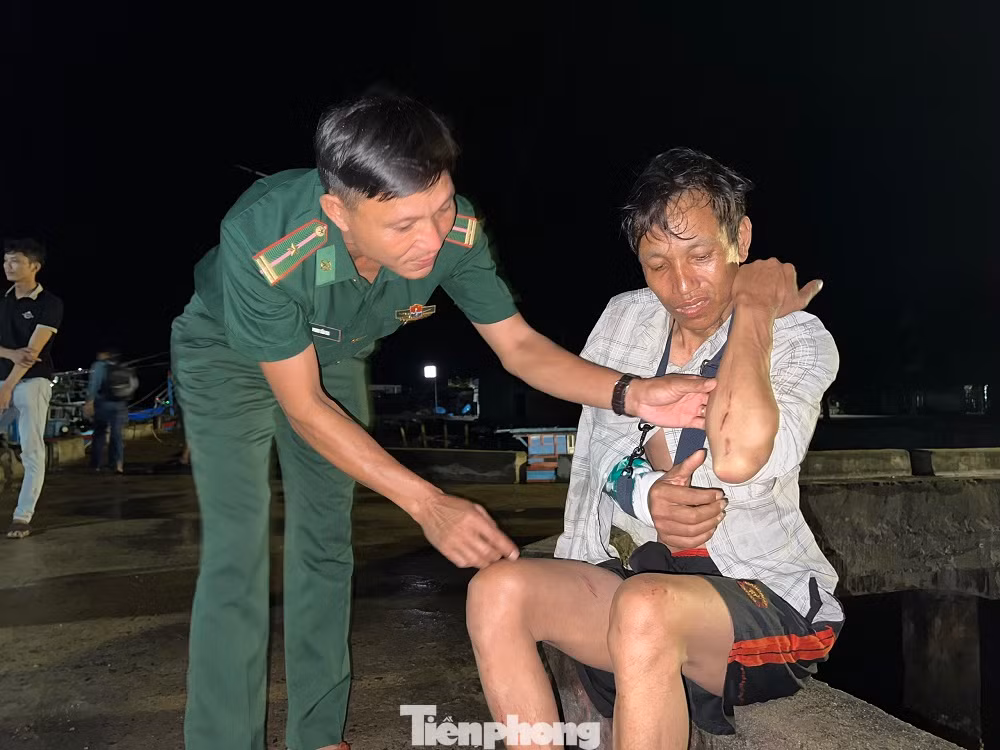 Hậu quả, khiến ngư dân Huỳnh Văn Hoanh (chủ tàu, máy trưởng) bị gãy tay phải và ngư dân Huỳnh Văn Tiến (thuyền trưởng) bị chấn thương vùng đầu. (Ảnh: Nguyễn Ngọc)