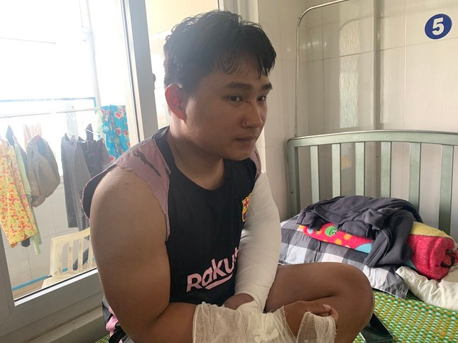 Shipper Lâm Anh Đạt bị người nhận hàng đánh gãy cả 2 tay. Shipper Lâm Anh Đạt bị người nhận hàng đánh gãy cả 2 tay.