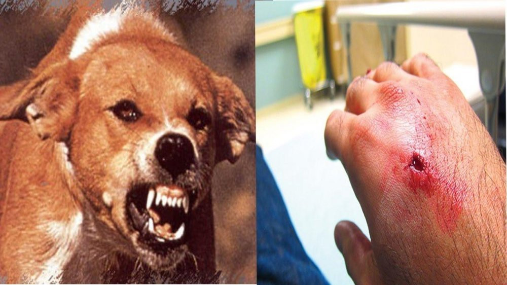 Người đàn ông ở Quảng Ngãi tử vong sau 2 tháng nghi bị chó dại cắn. (Ảnh minh họa) Người đàn ông ở Quảng Ngãi tử vong sau 2 tháng nghi bị chó dại cắn. (Ảnh minh họa)