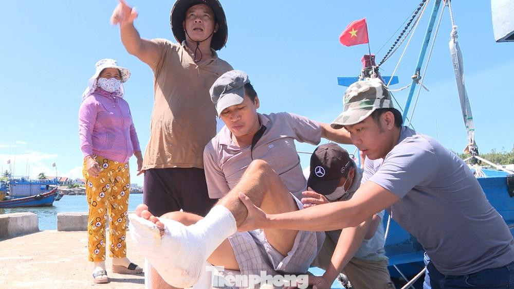 Ngư dân Quân bị ca nô nước ngoài bắn bị thương ở chân.