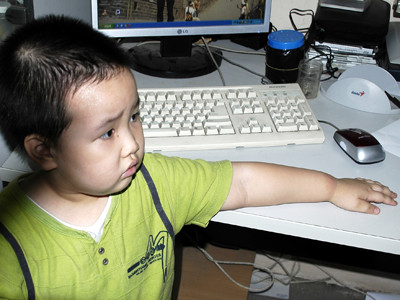 Cháu Tạ Đăng Quang, 3 tuổi ở ngõ 175, Cầu Giấy bị bọ xít đốt ở tay, chân và lưng Ảnh: Chụp tại phòng côn trùng học lúc 17 giờ 30 ngày 16-9	Ảnh: Phạm Yên