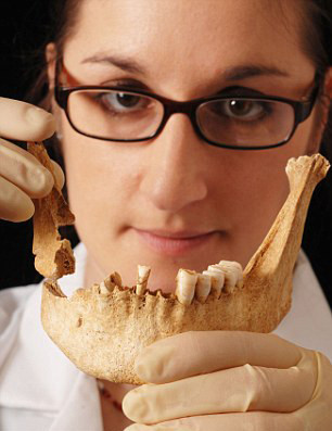 Hàm răng thiếu răng