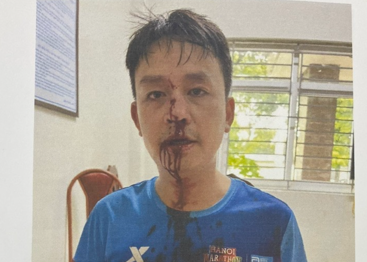 Bị hại Nguyễn Duy Thanh.