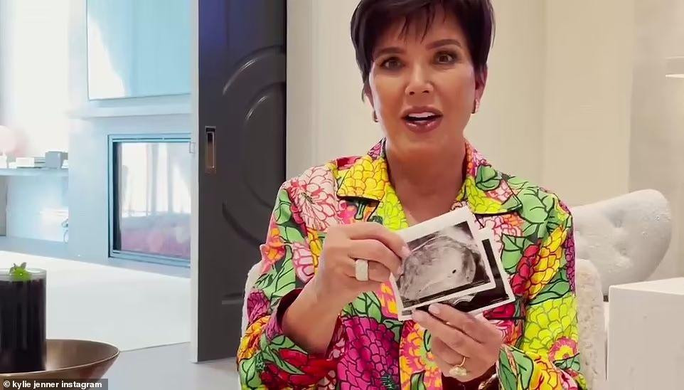 Bà Kris Jenner bất ngờ lúc nhận ảnh siêu âm.