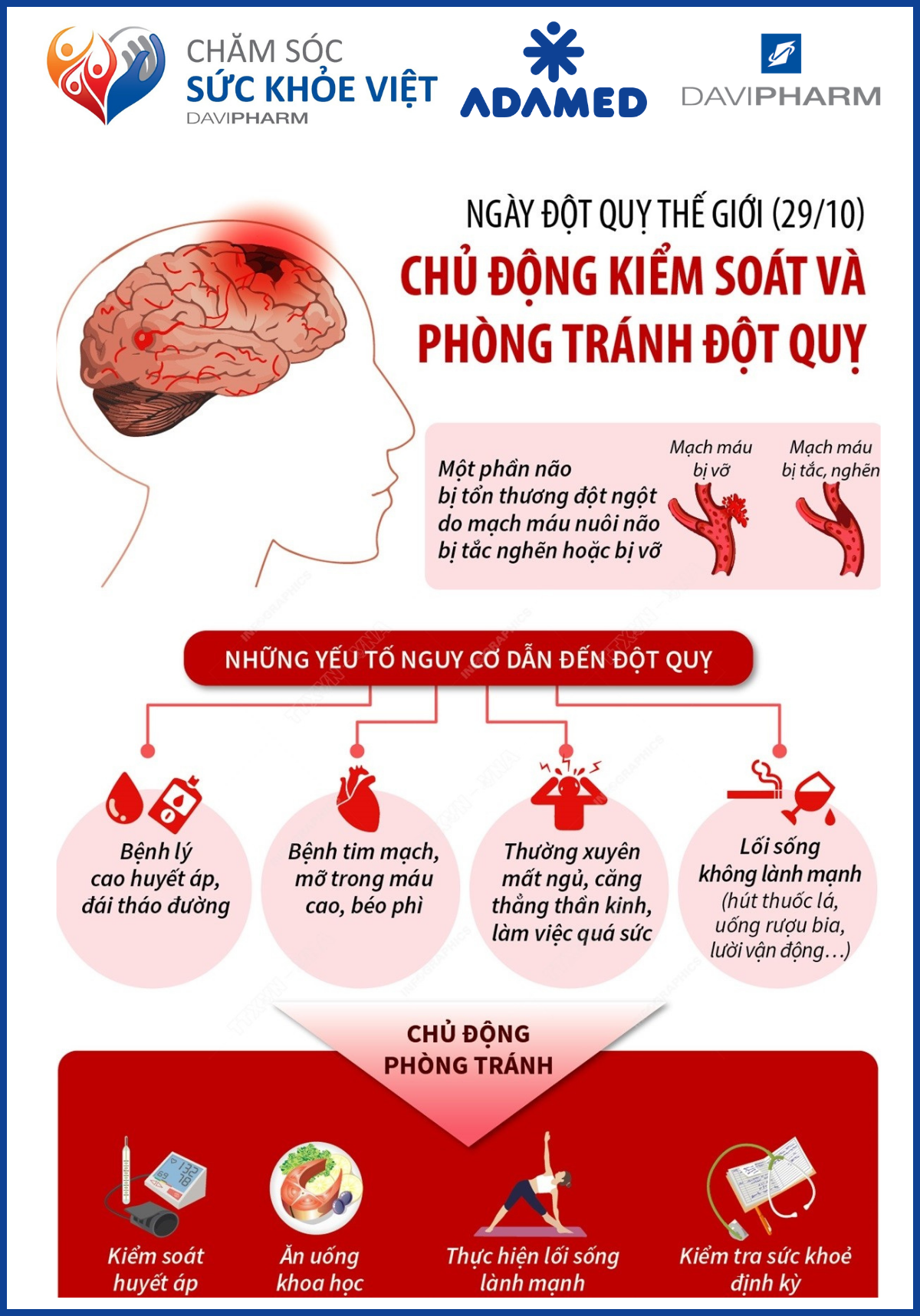 Hiểu các yếu tố nguy cơ đột quỵ để phòng ngừa sớm. (Nguồn: Chăm Sóc Sức Khỏe Việt)