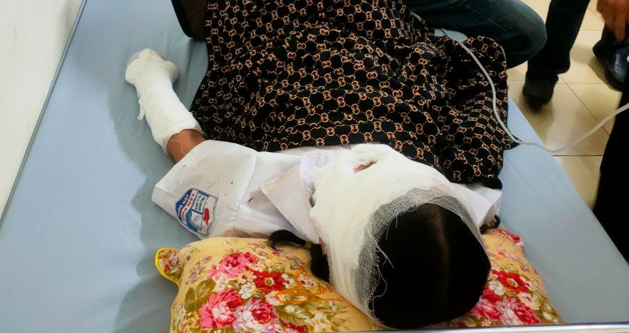 Sau khi được sơ cứu tại trạm y tế xã, các học sinh bị bỏng được người nhà và thầy cô chuyển lên Bệnh viện đa khoa huyện Yên Định để theo dõi, điều trị. Sau khi được sơ cứu tại trạm y tế xã, các học sinh bị bỏng được người nhà và thầy cô chuyển lên Bệnh viện đa khoa huyện Yên Định để theo dõi, điều trị.