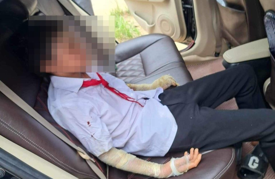 Một học sinh bị thương được đưa đi nhập viện.