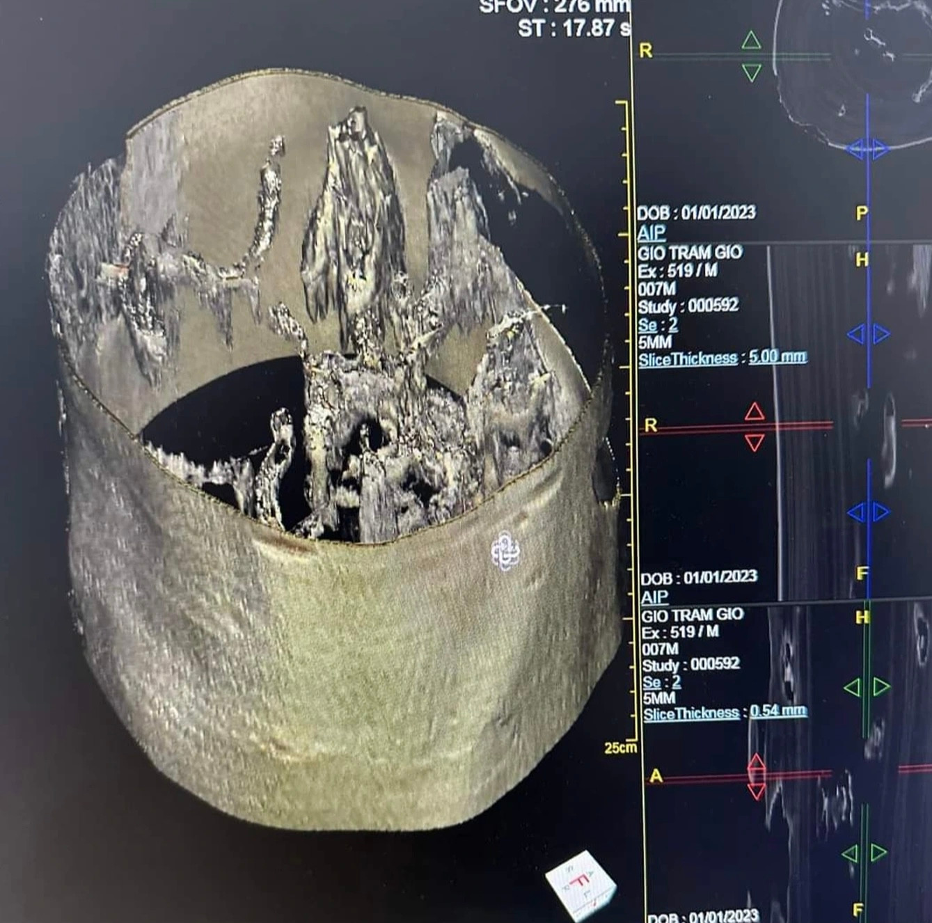 Hình ảnh kết quả chụp CT từ thân cây dó trầm (Ảnh: Quốc Khánh).