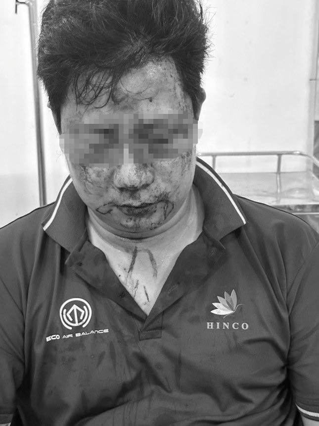 Nam tài xế được công an đưa vào bệnh viện cấp cứu sau khi bị đánh hội đồng. Nam tài xế được công an đưa vào bệnh viện cấp cứu sau khi bị đánh hội đồng.