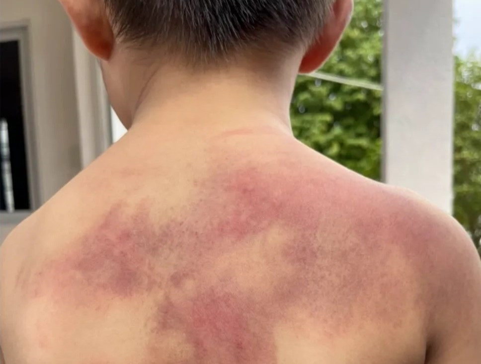 Cháu bé bị Minh bạo hành Cháu bé bị Minh bạo hành