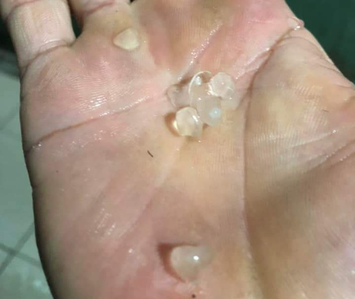 Mưa đá xảy ra tại TP. Biên Hòa vào chiều 8/5.