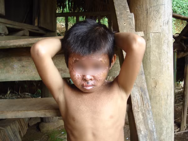 Em Xa Văn Tâm ở xóm Chiềng Cang, Mường Chiềng