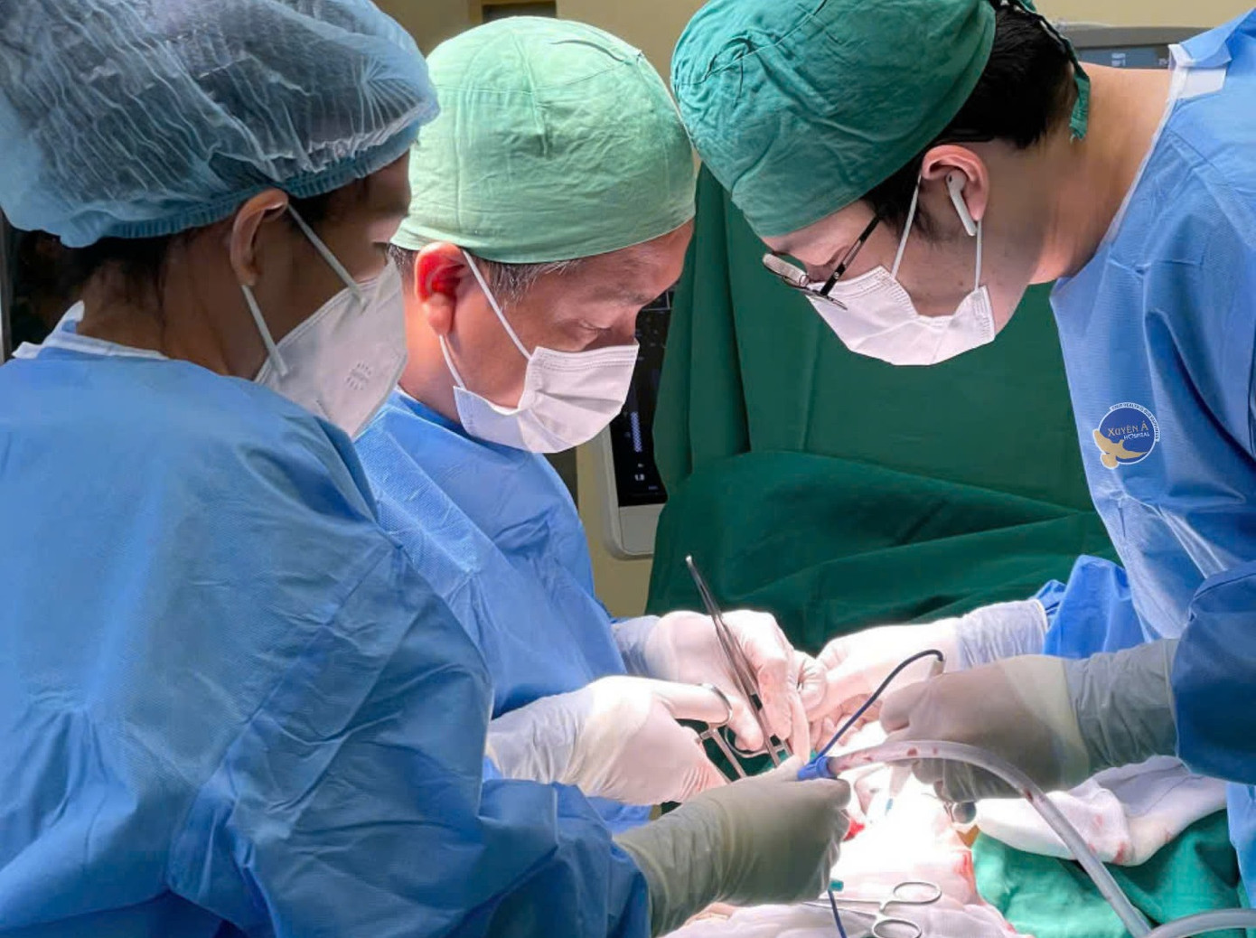 Ê kíp phẫu thuật đã lấy ra hàng chục viên sỏi san hô trong bể thận của bệnh nhân Ê kíp phẫu thuật đã lấy ra hàng chục viên sỏi san hô trong bể thận của bệnh nhân