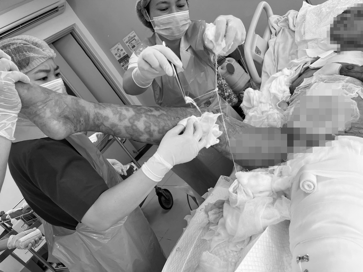 Các bác sĩ đã nỗ lực điều trị giúp bệnh nhân qua nguy kịch