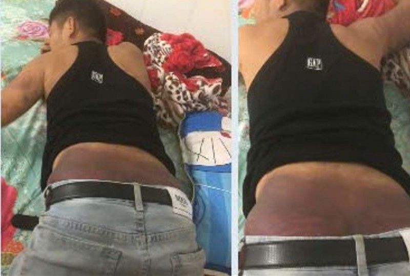 Nhiều nạn nhân rơi vào bẫy của bọn buôn người bị tra tấn, hành hạ dã man (ảnh minh họa) Nhiều nạn nhân rơi vào bẫy của bọn buôn người bị tra tấn, hành hạ dã man (ảnh minh họa)