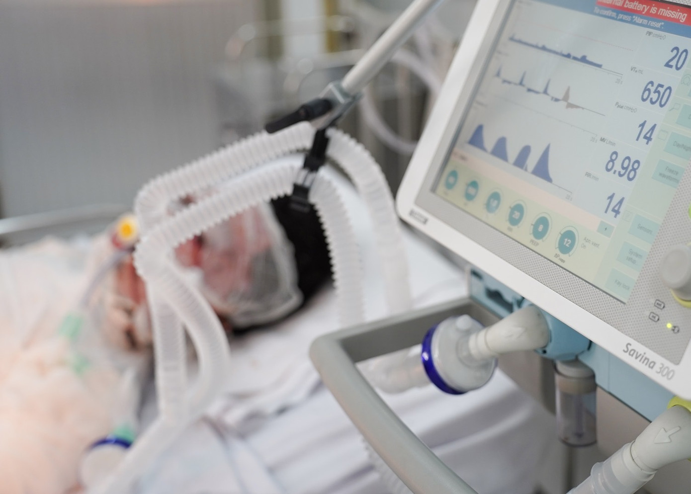 Hơn 1 tháng qua, hàng loạt vụ tai nạn do pháo tự chế xảy ra trên cả nước