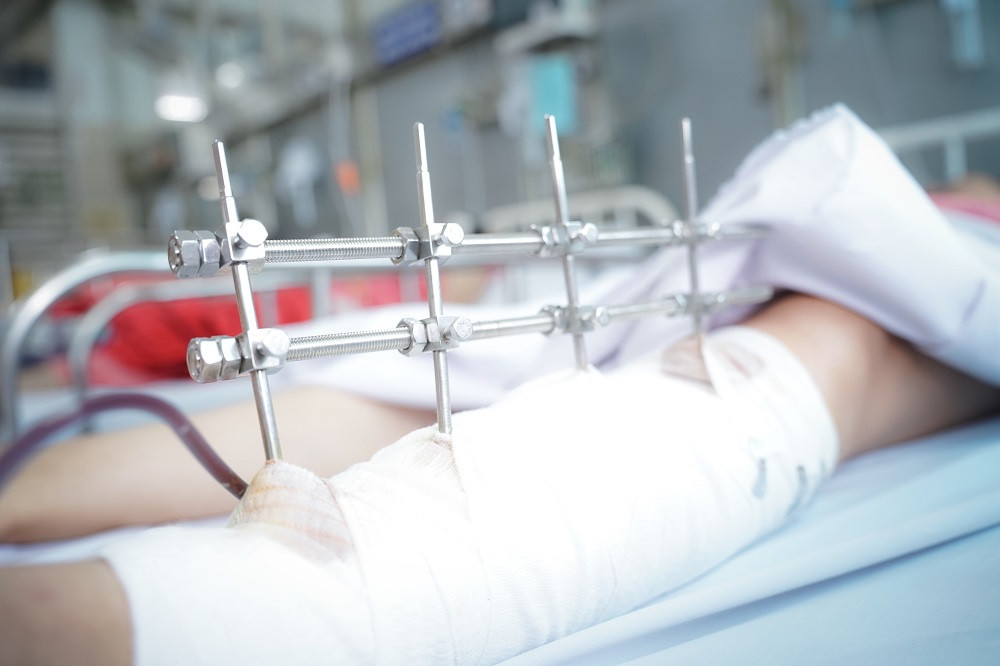 Nạn nhân bị đa chấn thương đe dọa trực tiếp đến tính mạng Nạn nhân bị đa chấn thương đe dọa trực tiếp đến tính mạng