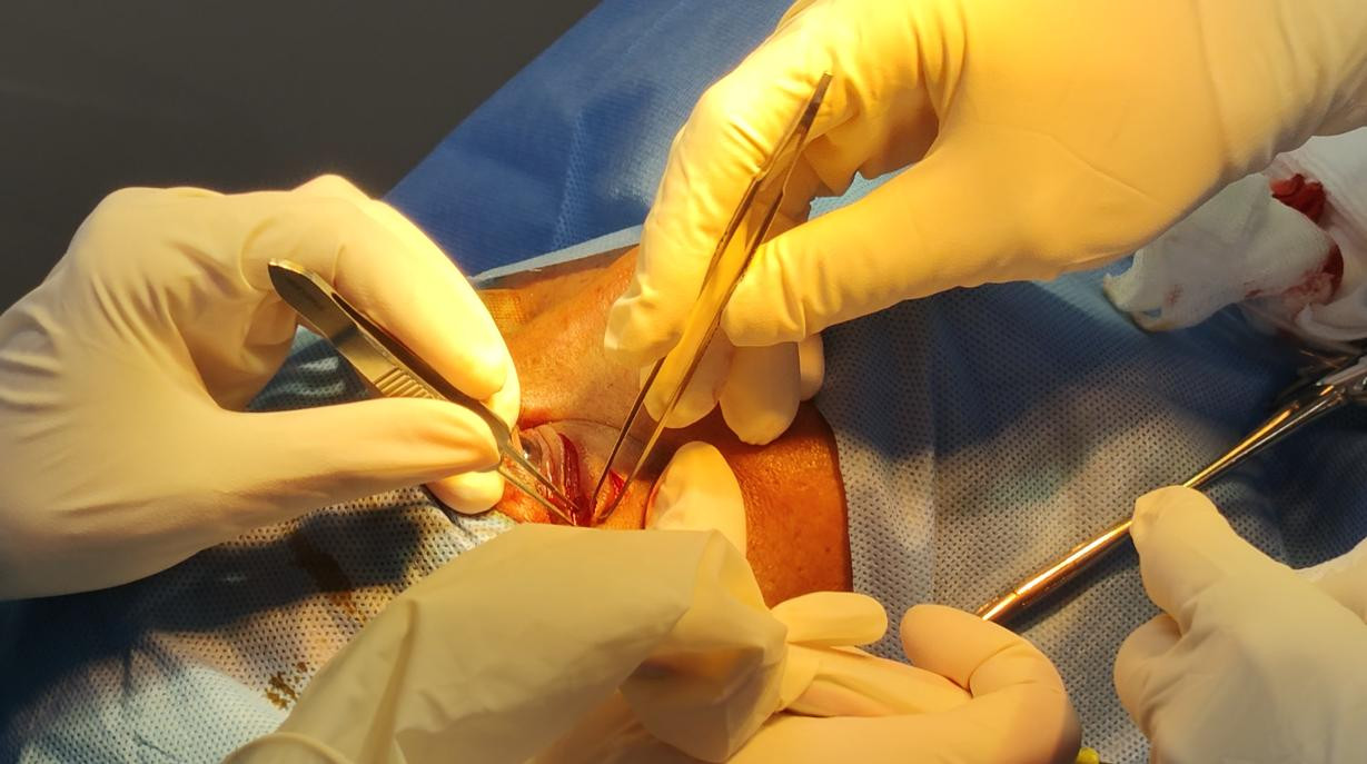 Các bác sĩ đã quyết định thực hiện phẫu thuật cho người bệnh Các bác sĩ đã quyết định thực hiện phẫu thuật cho người bệnh