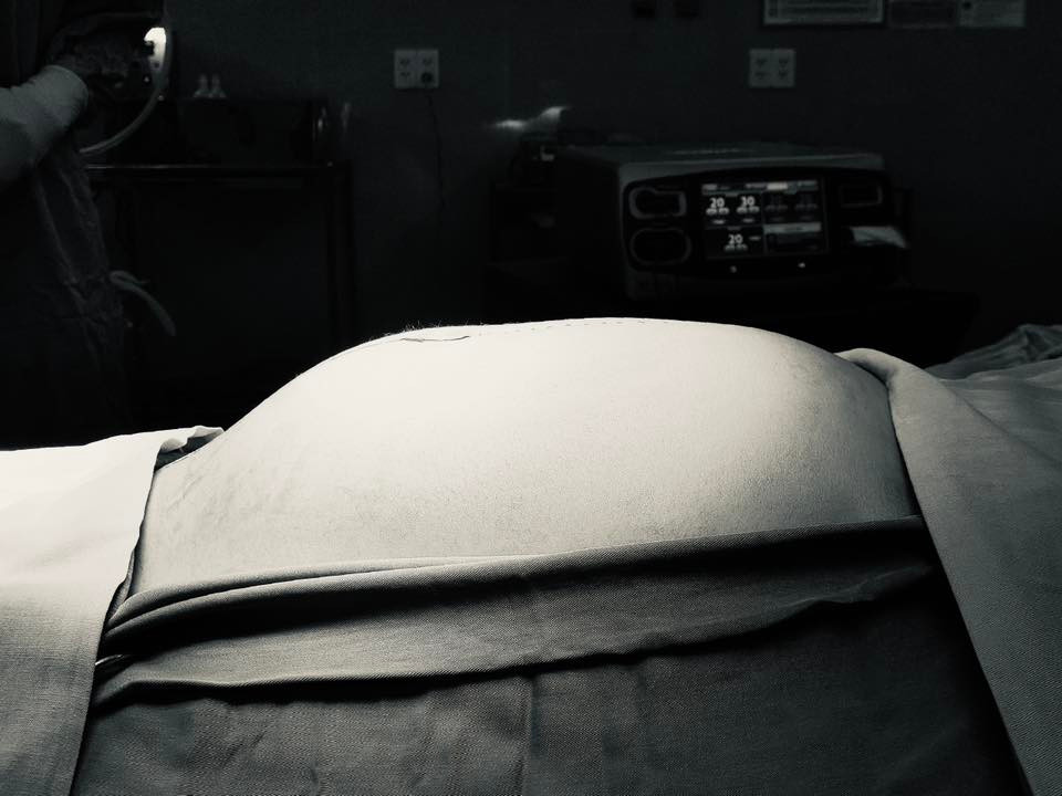 Các bác sĩ đã quyết định thực hiện cuộc phẫu thuật lấy trọn khối u cho bệnh nhi