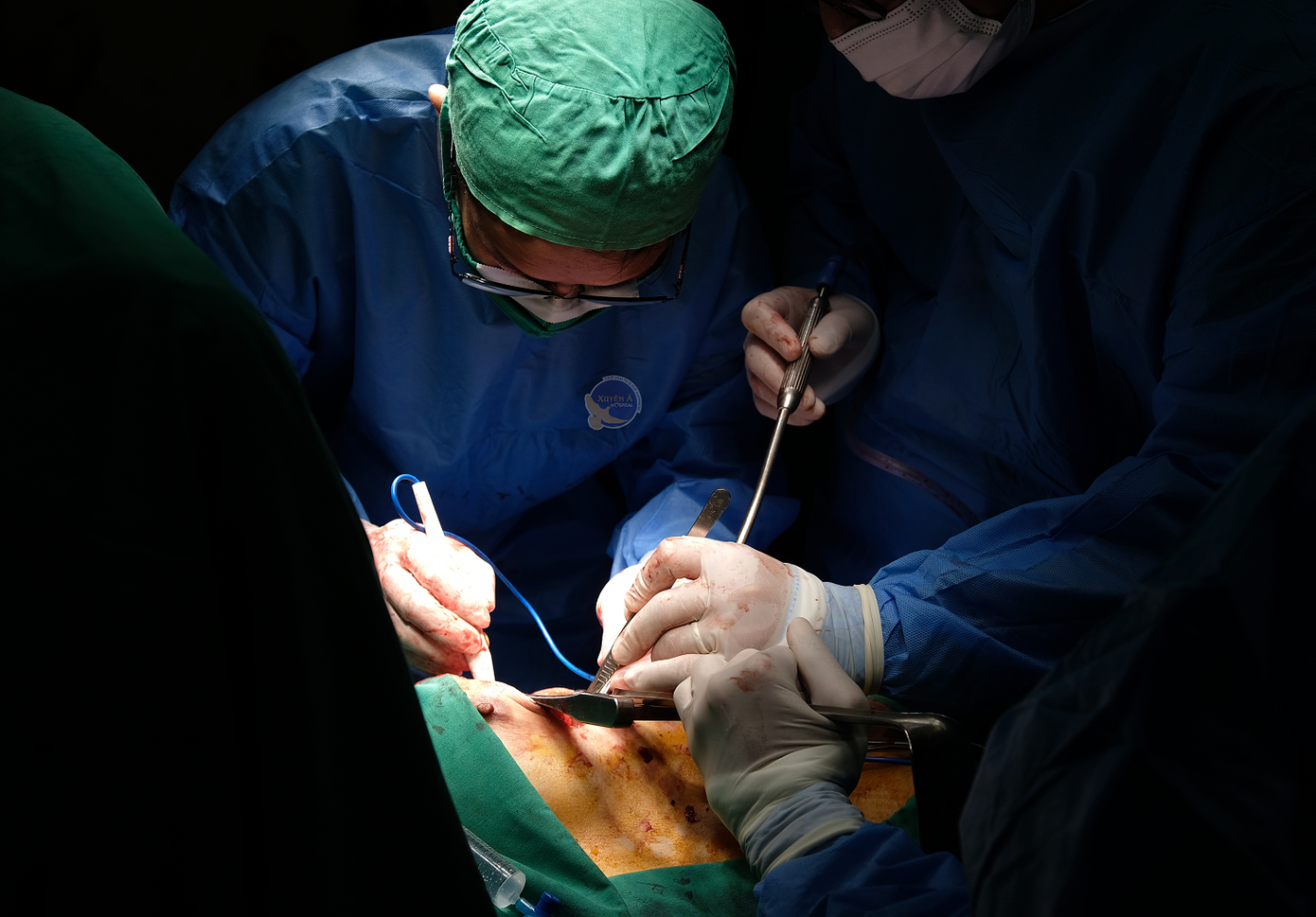 Các bác sĩ đã thực hiện cuộc phẫu thuật khẩn nguy giúp bệnh nhân qua cơn nguy kịch Các bác sĩ đã thực hiện cuộc phẫu thuật khẩn nguy giúp bệnh nhân qua cơn nguy kịch