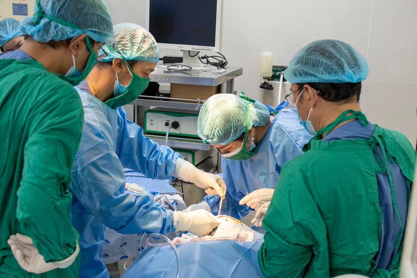 Các bác sĩ 2 bệnh viện đã phối hợp lấy thành công dị vật là chiếc đũa bị gãy trong hốc mắt người bệnh Các bác sĩ 2 bệnh viện đã phối hợp lấy thành công dị vật là chiếc đũa bị gãy trong hốc mắt người bệnh