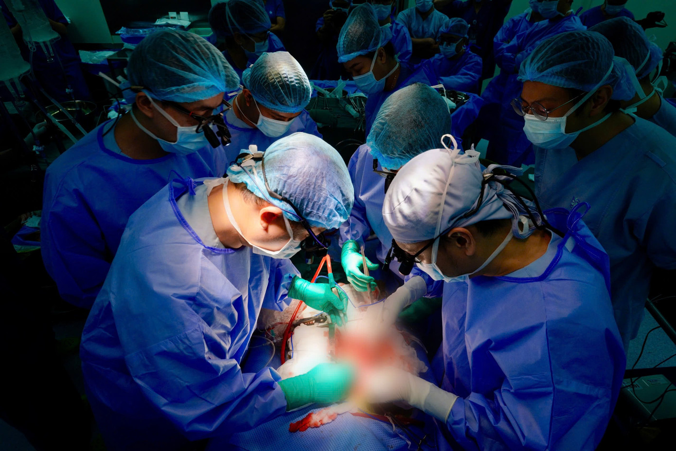 Các cuộc ghép tạng đã diễn ra thành công sau những nỗ lực không ngừng nghỉ của các y bác sĩ Các cuộc ghép tạng đã diễn ra thành công sau những nỗ lực không ngừng nghỉ của các y bác sĩ