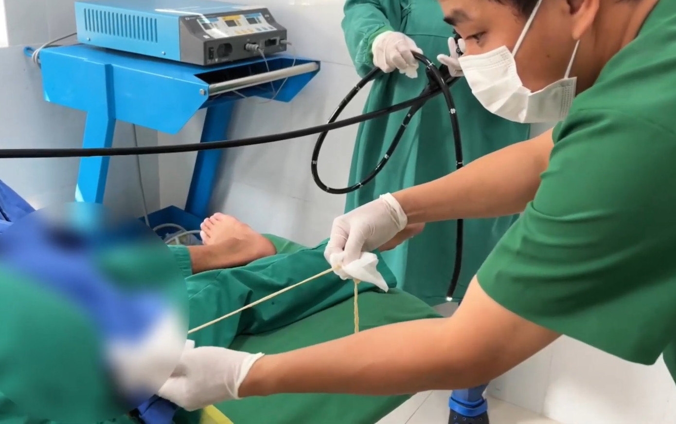 Các bác sĩ thực hiện thủ thuật kéo sán dây ra khỏi cơ thể người bệnh Các bác sĩ thực hiện thủ thuật kéo sán dây ra khỏi cơ thể người bệnh