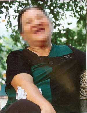 Bác Lành đã rụng răng