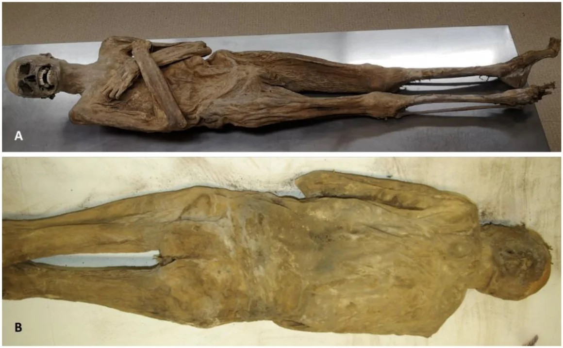 Xác ướp bí ẩn có biệt danh là "vị mục sư phơi khô" được cất giữ trong hầm mộ của Nhà thờ St. Thomas am Blasenstein, một nhà thờ ở bang Thượng Áo của Áo.Nhìn từ phía trước (A) và phía sau (B) của xác ướp, không thấy có vết rạch nào trên cơ thể. (Ảnh: brandstaetter/Hulton Archive)