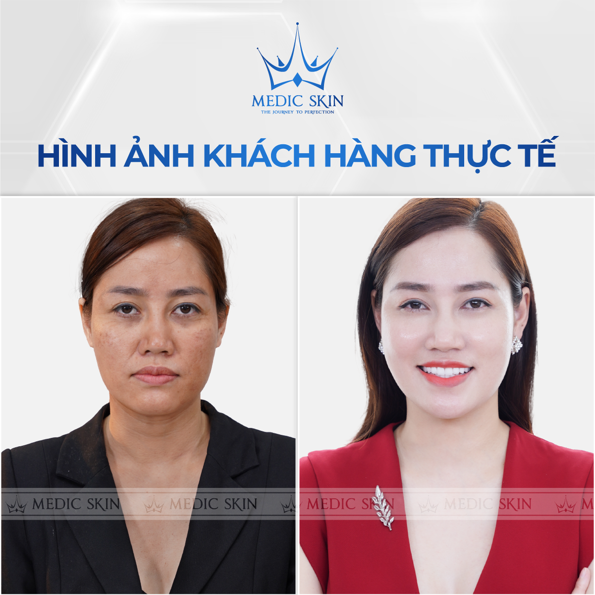 Chị Khánh Linh sau 60 phút trải nghiệm dịch vụ Therapy 6D