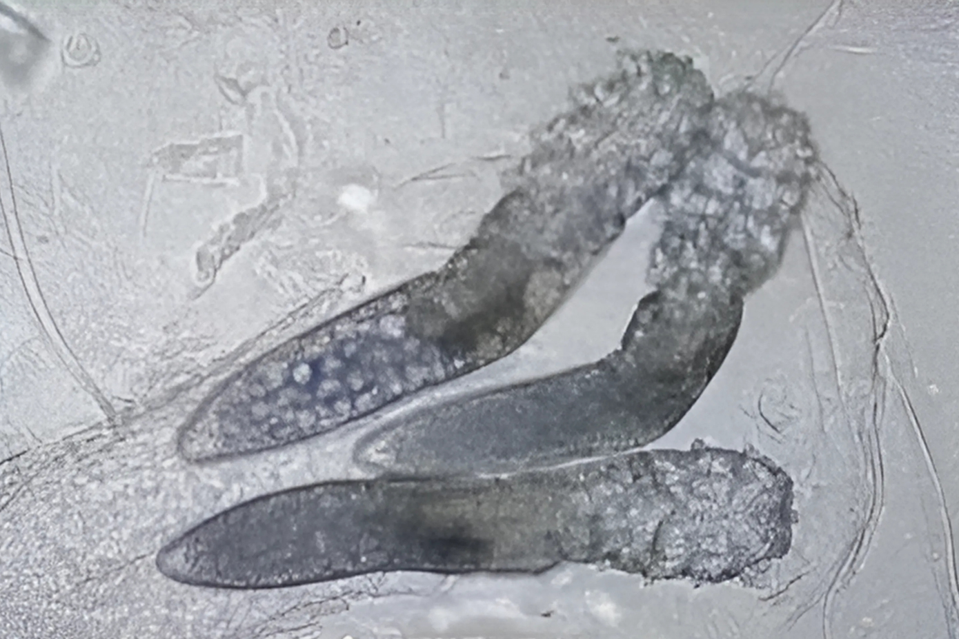 Qua tìm hiểu, bác sĩ Đặng Quân phát hiện Tiểu Hạo có thói quen ăn nhiều đồ chiên rán và đồ ngọt. Đây chính là những "món khoái khẩu" của loại ve mạt Demodex - thủ phạm gây ra tình trạng trên. Ảnh: Jimu News. Qua tìm hiểu, bác sĩ Đặng Quân phát hiện Tiểu Hạo có thói quen ăn nhiều đồ chiên rán và đồ ngọt. Đây chính là những "món khoái khẩu" của loại ve mạt Demodex - thủ phạm gây ra tình trạng trên. Ảnh: Jimu News.