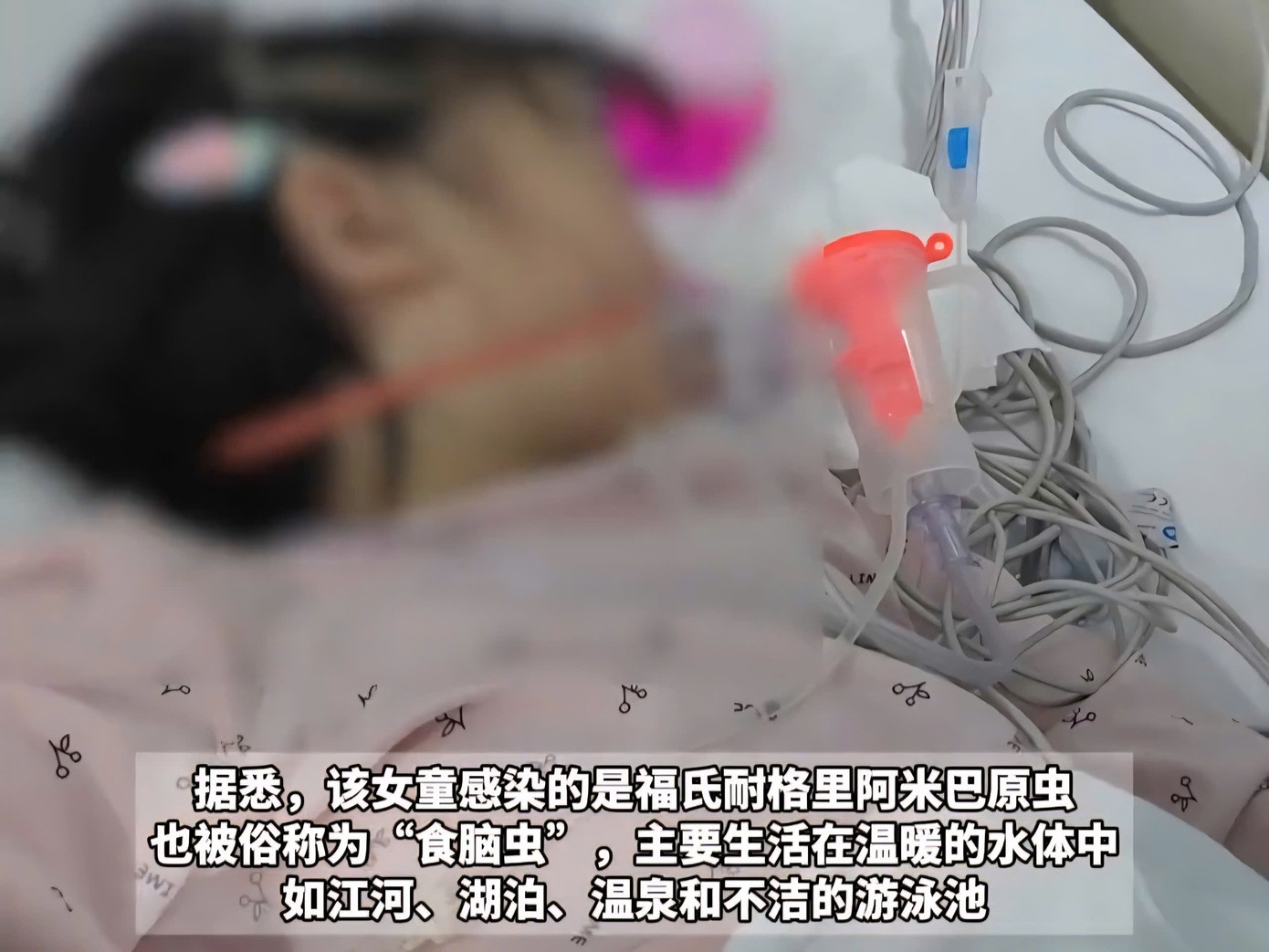 "Vi khuẩn ăn não" có trong nước ngọt (hồ, suối). Hạnh Nhi bị nhiễm và tình trạng vẫn chưa có tiến triển tốt. "Vi khuẩn ăn não" có trong nước ngọt (hồ, suối). Hạnh Nhi bị nhiễm và tình trạng vẫn chưa có tiến triển tốt.