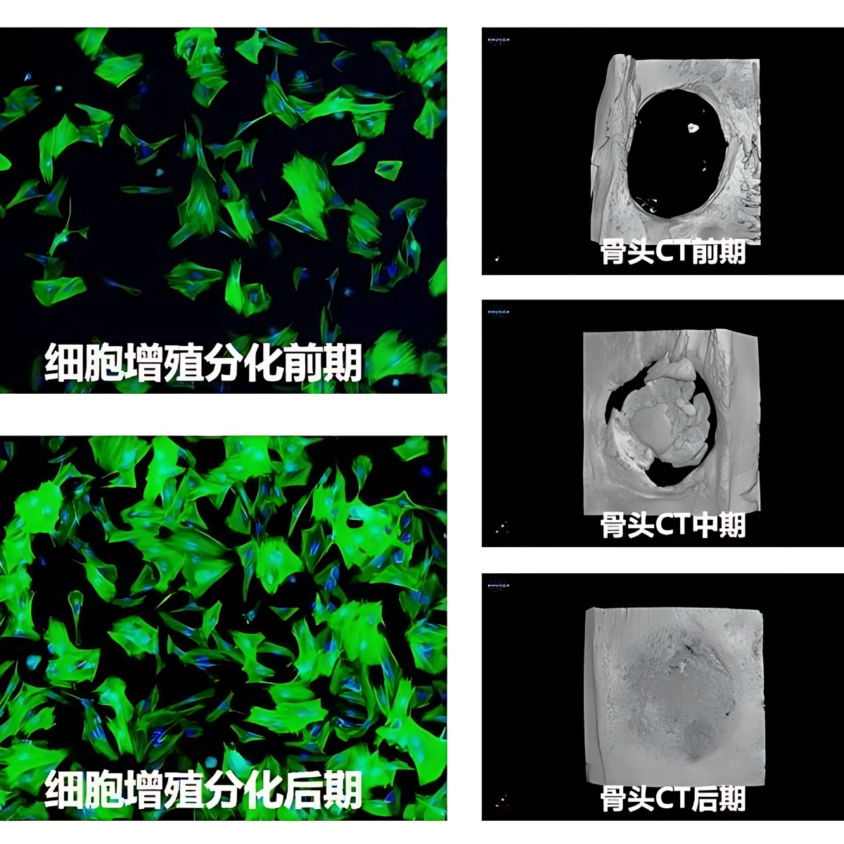 Ảnh chụp CT theo dõi quá trình phát triển khung xương.