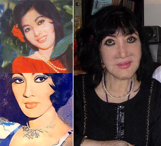 Sao Việt và những hậu quả làm đẹp ảnh 12