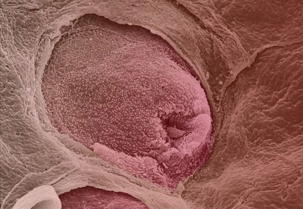 Các chồi vị giác ở lưỡi (còn gọi là nụ vị giác). Trên bề mặt lưỡi người có khoảng 10.000 nụ vị giác chịu trách nhiệm phát hiện các tín hiệu về vị khác nhau như mặn, cay, đắng, ngọt và ngon. Các chồi vị giác ở lưỡi (còn gọi là nụ vị giác). Trên bề mặt lưỡi người có khoảng 10.000 nụ vị giác chịu trách nhiệm phát hiện các tín hiệu về vị khác nhau như mặn, cay, đắng, ngọt và ngon