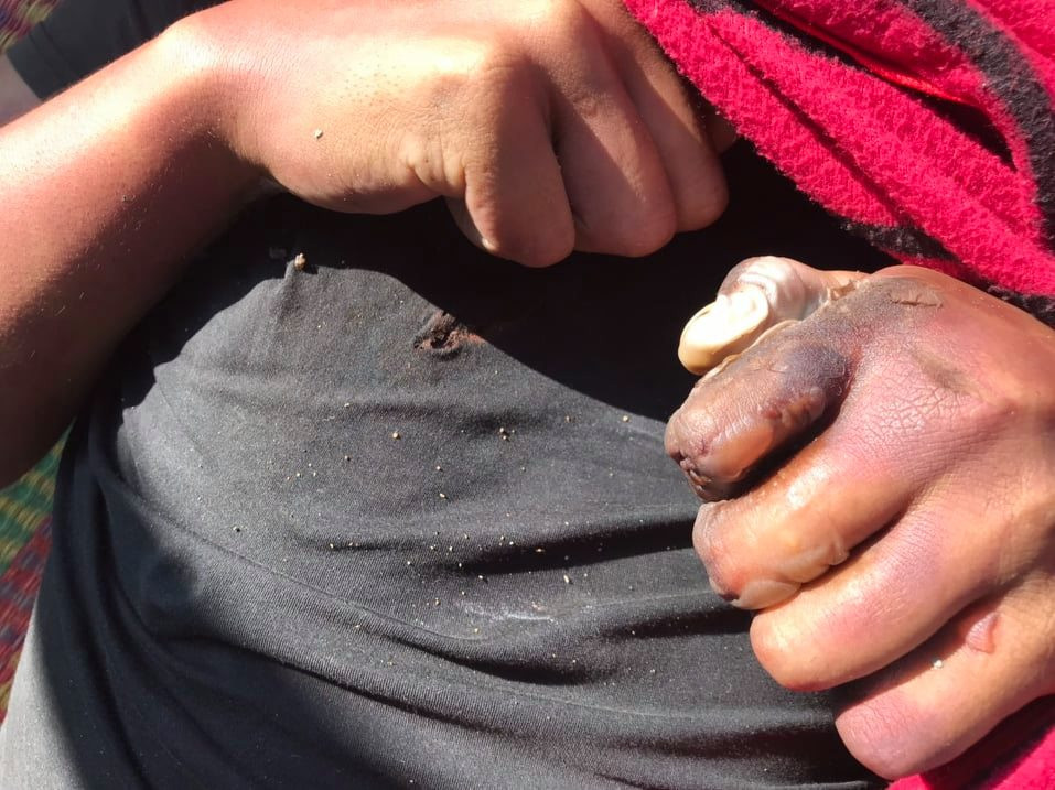 Điện thoại phát nổ trong lúc sạc pin, nam thanh niên tử vong ảnh 1