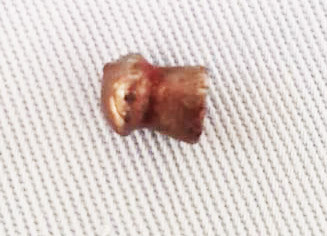 Một thanh niên bị bắn xuyên thủng bụng khi đang làm vườn ảnh 1