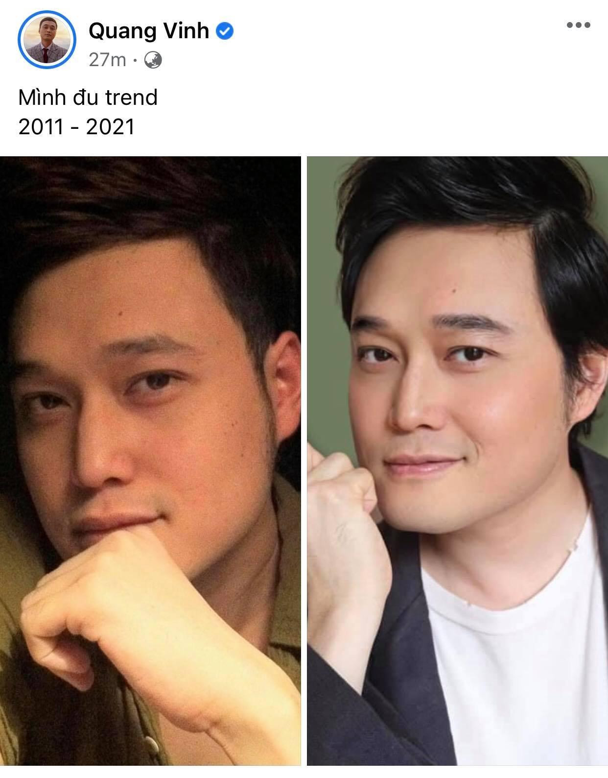 Ca sĩ Quang Vinh khiến netizen trầm trồ khi bị thời gian bỏ quên, không hề khác biệt! Ca sĩ Quang Vinh khiến netizen trầm trồ khi bị thời gian bỏ quên, không hề khác biệt!