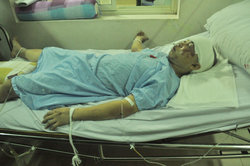 Thiếu úy Nguyễn Hà Lâm đang được điều trị tích cực tại Bệnh viện Việt - Đức