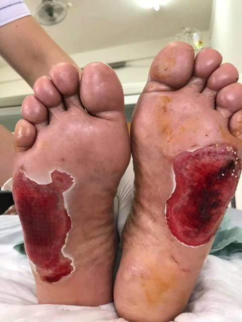 Sự thật kinh hoàng về tác dụng chữa bách bệnh của 'cặp đá kỳ diệu' ảnh 1