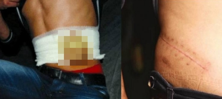 Anh chàng Tiểu Vương đã bán một bên thận của mình để mua được chiếc điện thoại mơ ước.